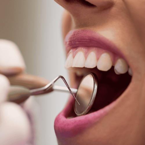 How to Find Best Procedure Wisdom Tooth Extraction in San Jose, Costa Rica